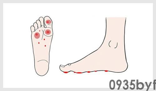 脚气症状的具体体现是怎样的呢