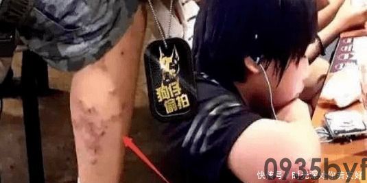 异位性皮炎什么意思