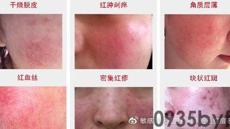 脸上有斑有