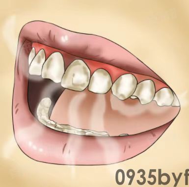 口腔有异味怎么去除(图1) 口腔有异味怎么去除(图1)