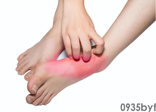 我国脚气患者过亿“祸根”被揪出：这些东西是脚气最大的帮凶(图3)