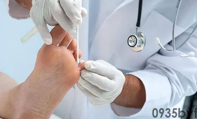 我国脚气患者上亿人这些东西才脚气的“祸根”！(图10)