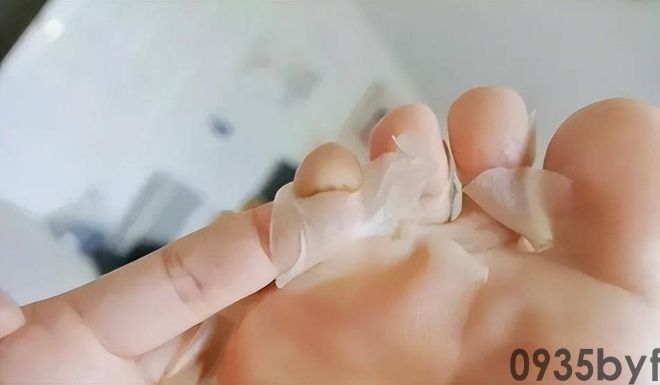 我国脚气患者上亿人这些东西才脚气的“祸根”！(图7)