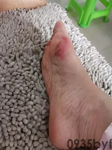 24款捷达vs5主动前锋版(图1) 24款捷达vs5主动前锋版