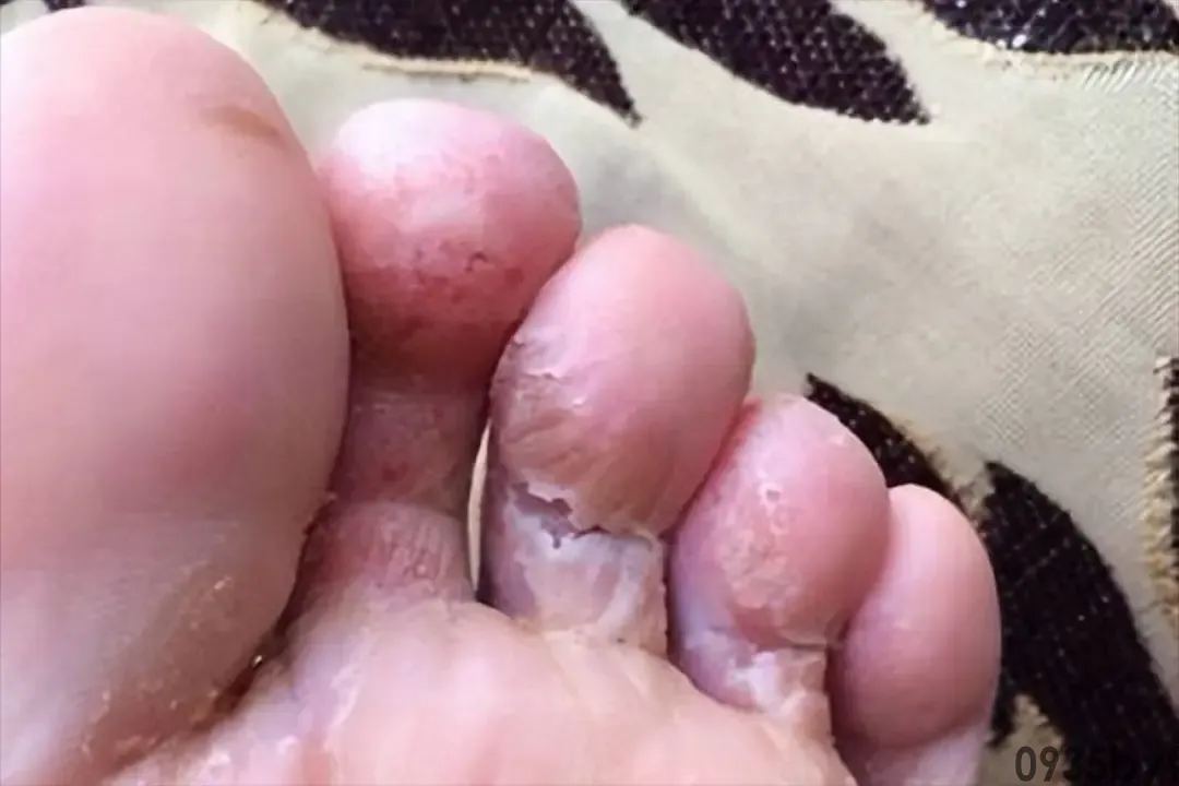 钢铁之躯2最新版本16