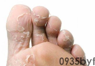 夏日多雨这些宁静隐患要留神（效劳窗·夏日宁静指南）