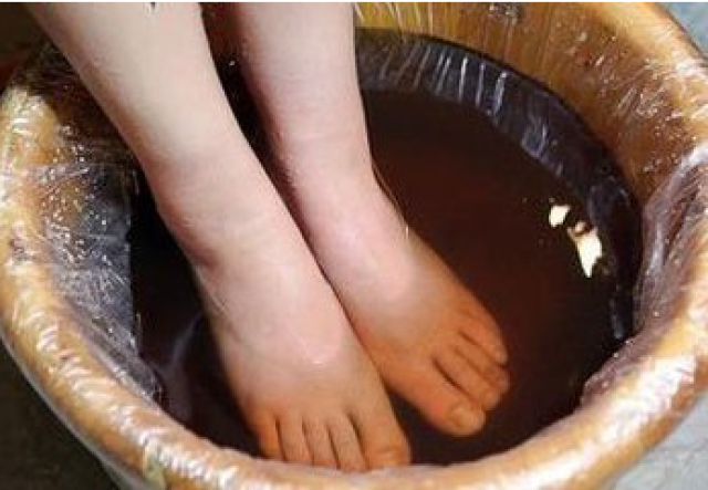 脚气脚痒怎样治