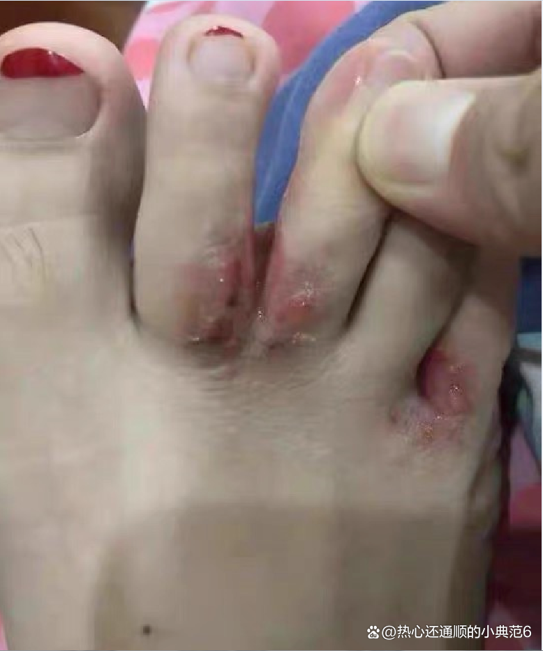跨界立异！九牧智能马桶表态威望肛肠年会
