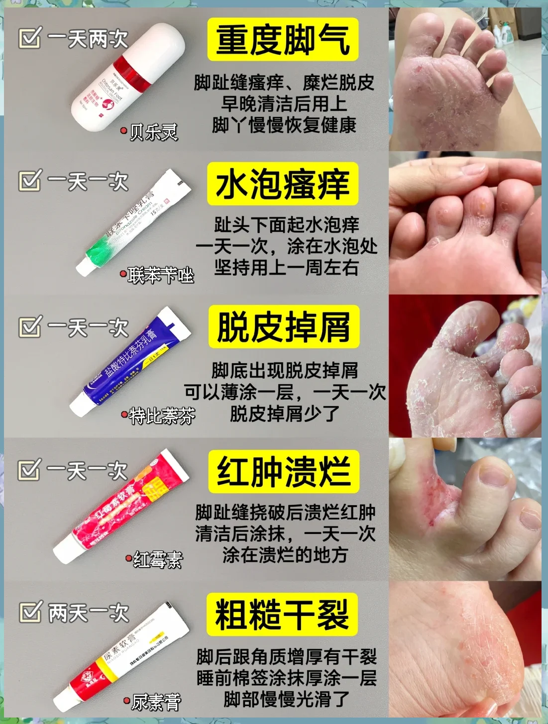 红斑脚气表皮加固养护(图1) 红斑脚气表皮加固养护