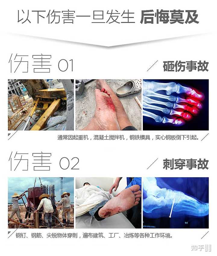 封闭工作鞋引发脚痒(图1) 封闭工作鞋引发脚痒