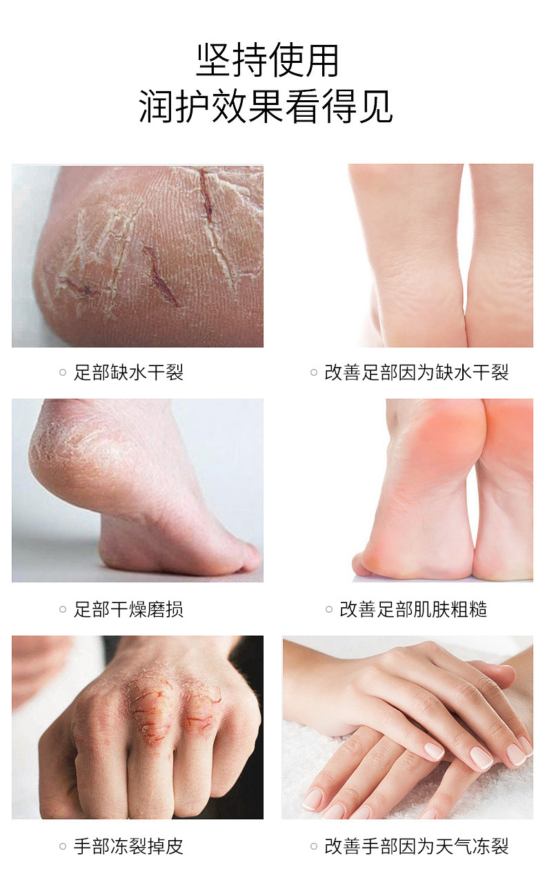 季节性足部肌肤敏感修护