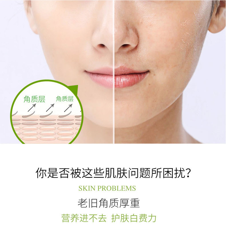 死皮堆积异味深层改善(图1) 死皮堆积异味深层改善