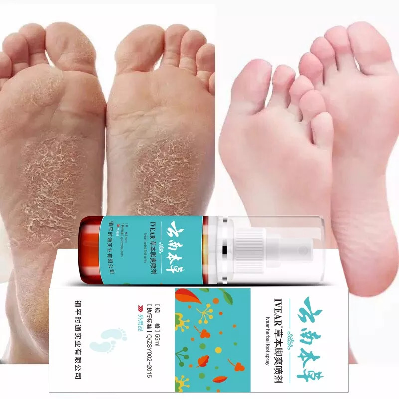 脚气异味同步消除(图1) 脚气异味同步消除