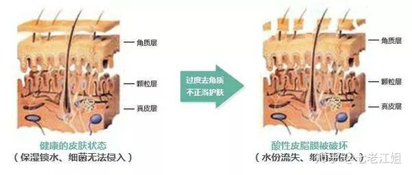 老旧角质自然脱落护理