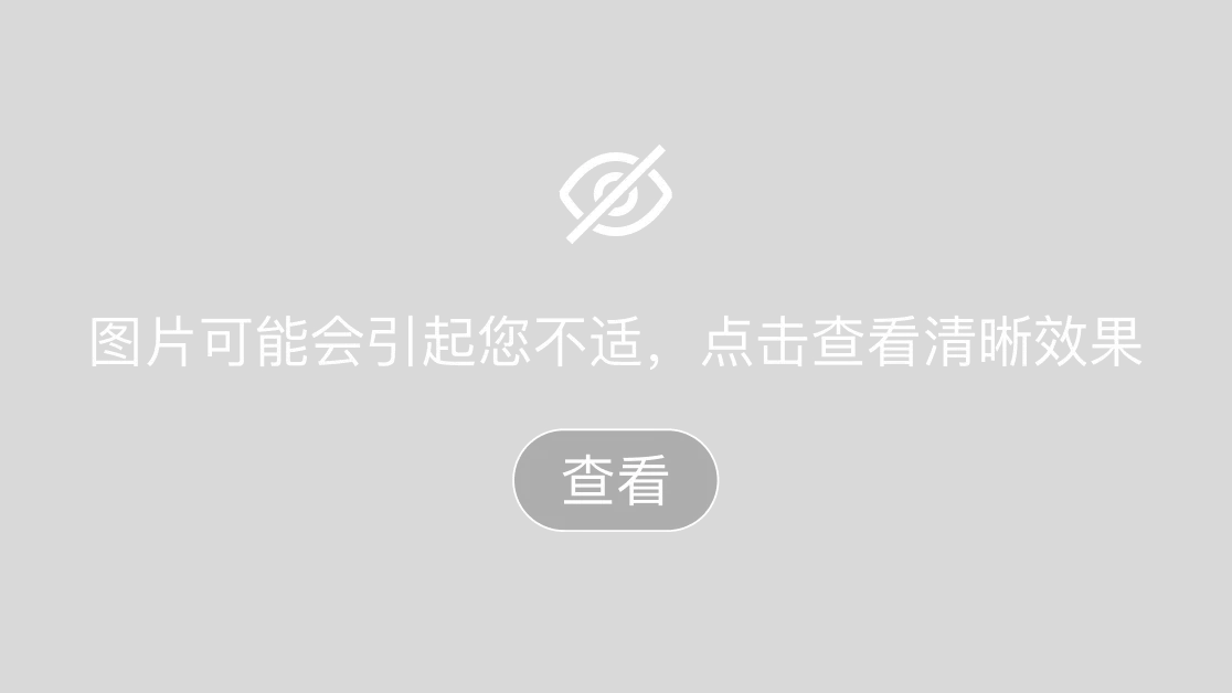 不同类型脚气的鉴别诊断(图1) 不同类型脚气的鉴别诊断