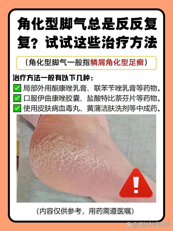 【临床研究】角化型脚气的治疗新突破