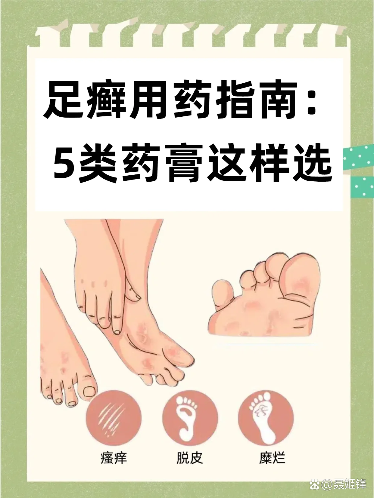 足部瘙痒预防常识(图1) 足部瘙痒预防常识
