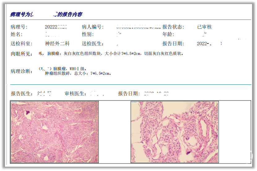 【病例分享】糜烂型脚气的成功治疗经验(图1) 【病例分享】糜烂型脚气的成功治疗经验