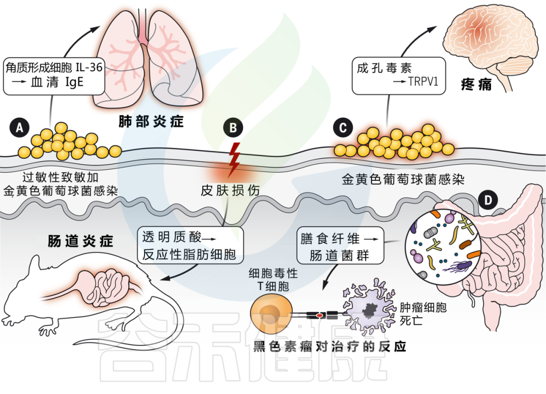细菌型糜烂快速处理(图1) 细菌型糜烂快速处理