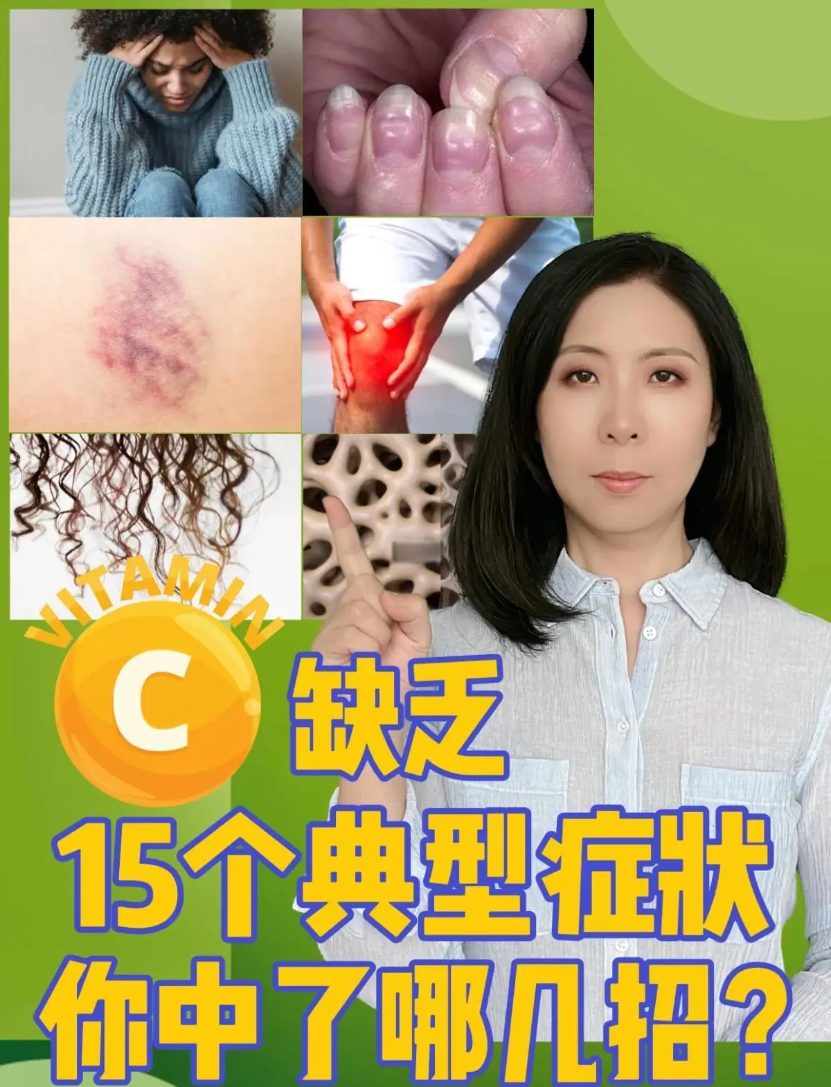 脚部红斑缺乏维生素 C 诱发