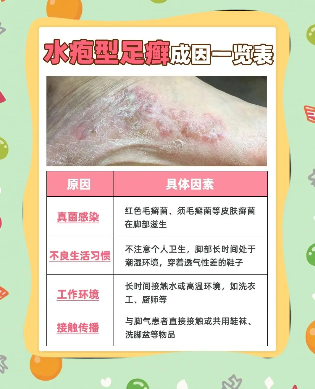 【健康问答】关于水疱型脚气的常见疑问(图1) 【健康问答】关于水疱型脚气的常见疑问