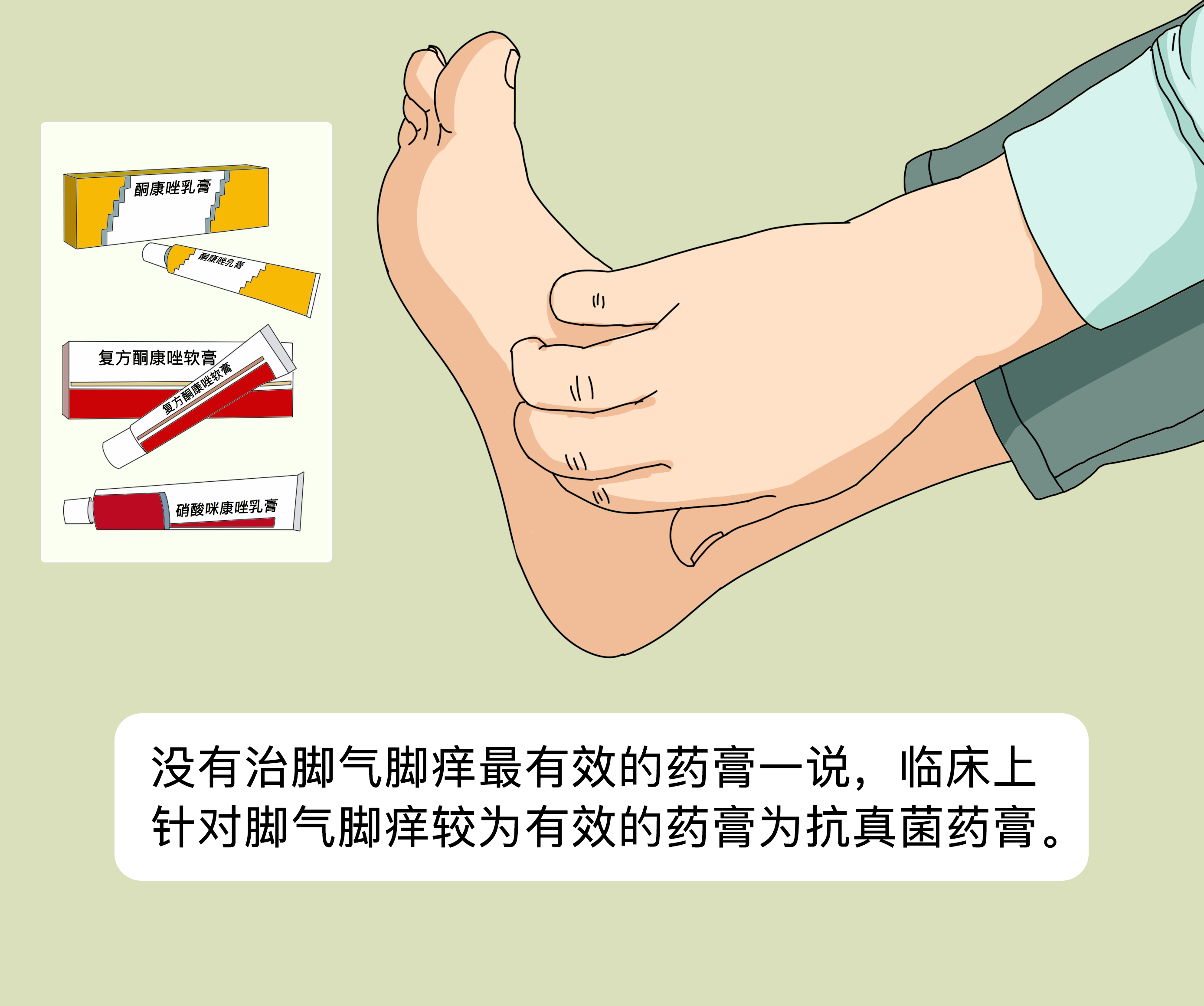 【专家解读】脚气用药的最新治疗方法(图1) 【专家解读】脚气用药的最新治疗方法