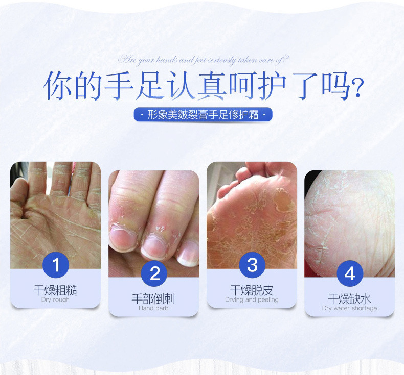 脚部糜烂涉水后快速修护