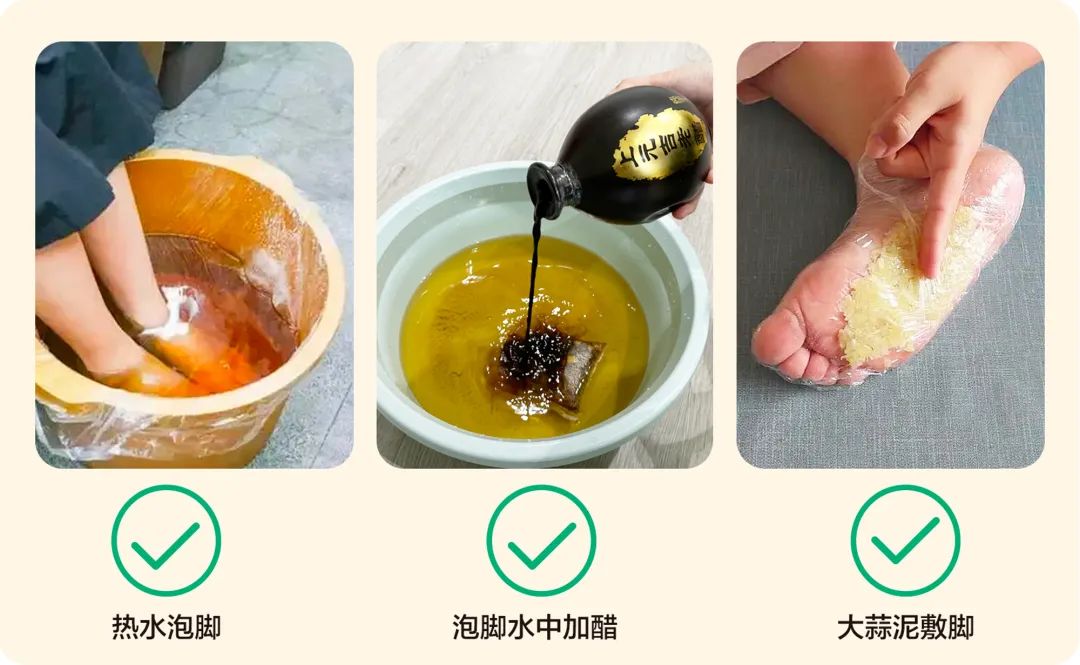 改善护肤不当脚脱皮(图1) 改善护肤不当脚脱皮