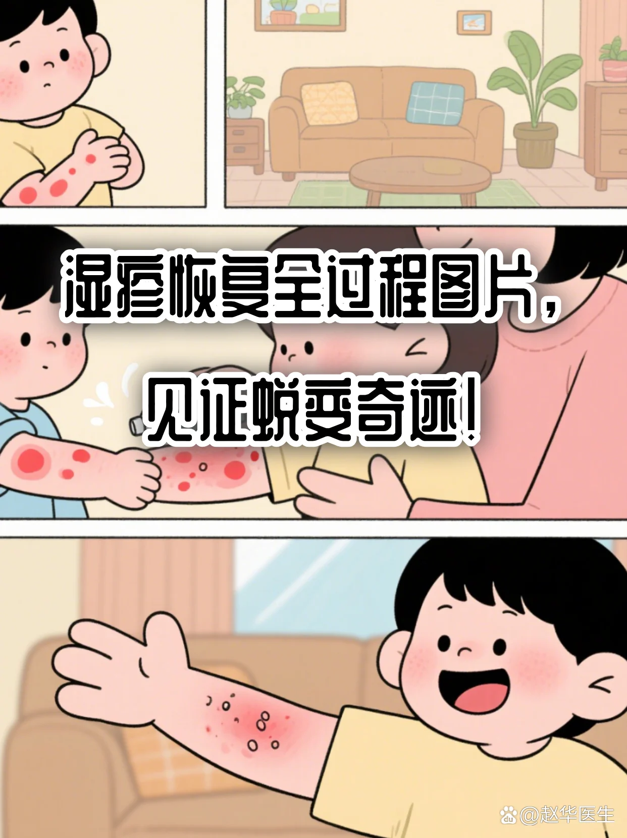 改善湿疹恢复期脱皮(图1) 改善湿疹恢复期脱皮