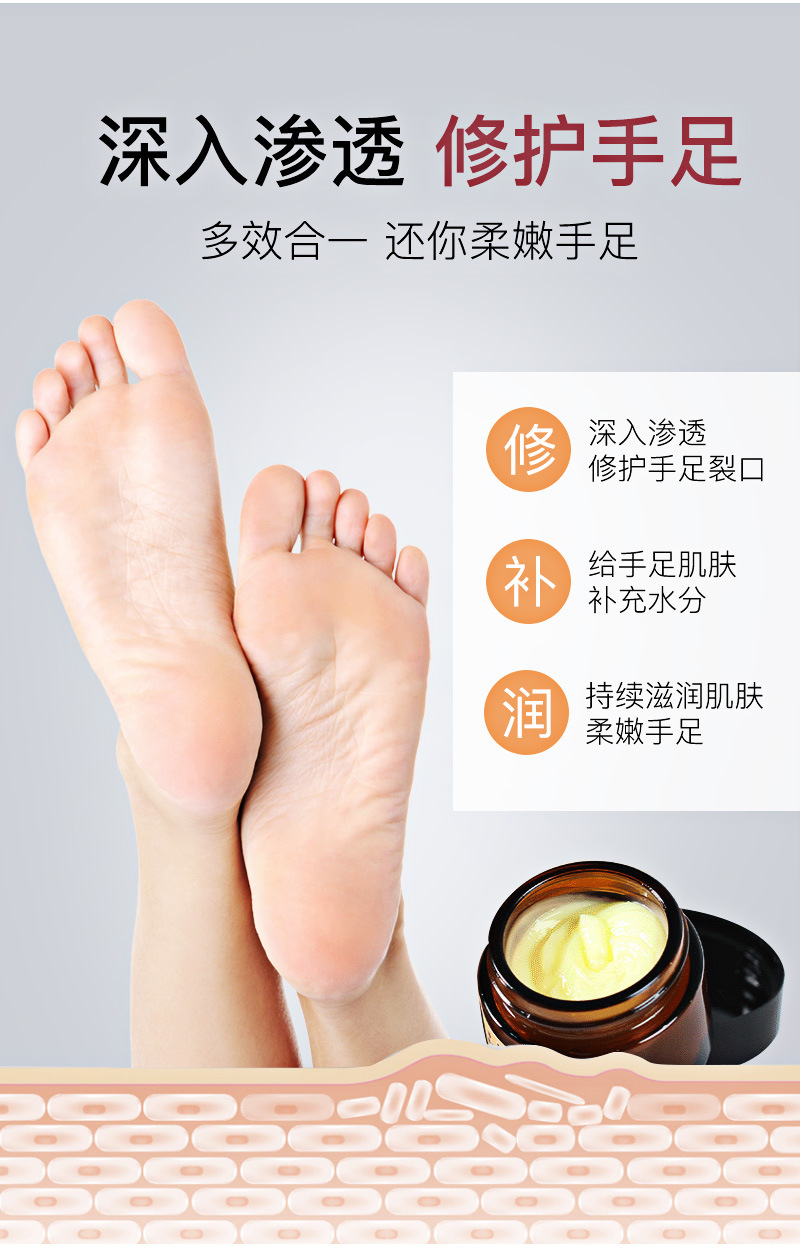 改善脚部油脂分泌不足(图1) 改善脚部油脂分泌不足