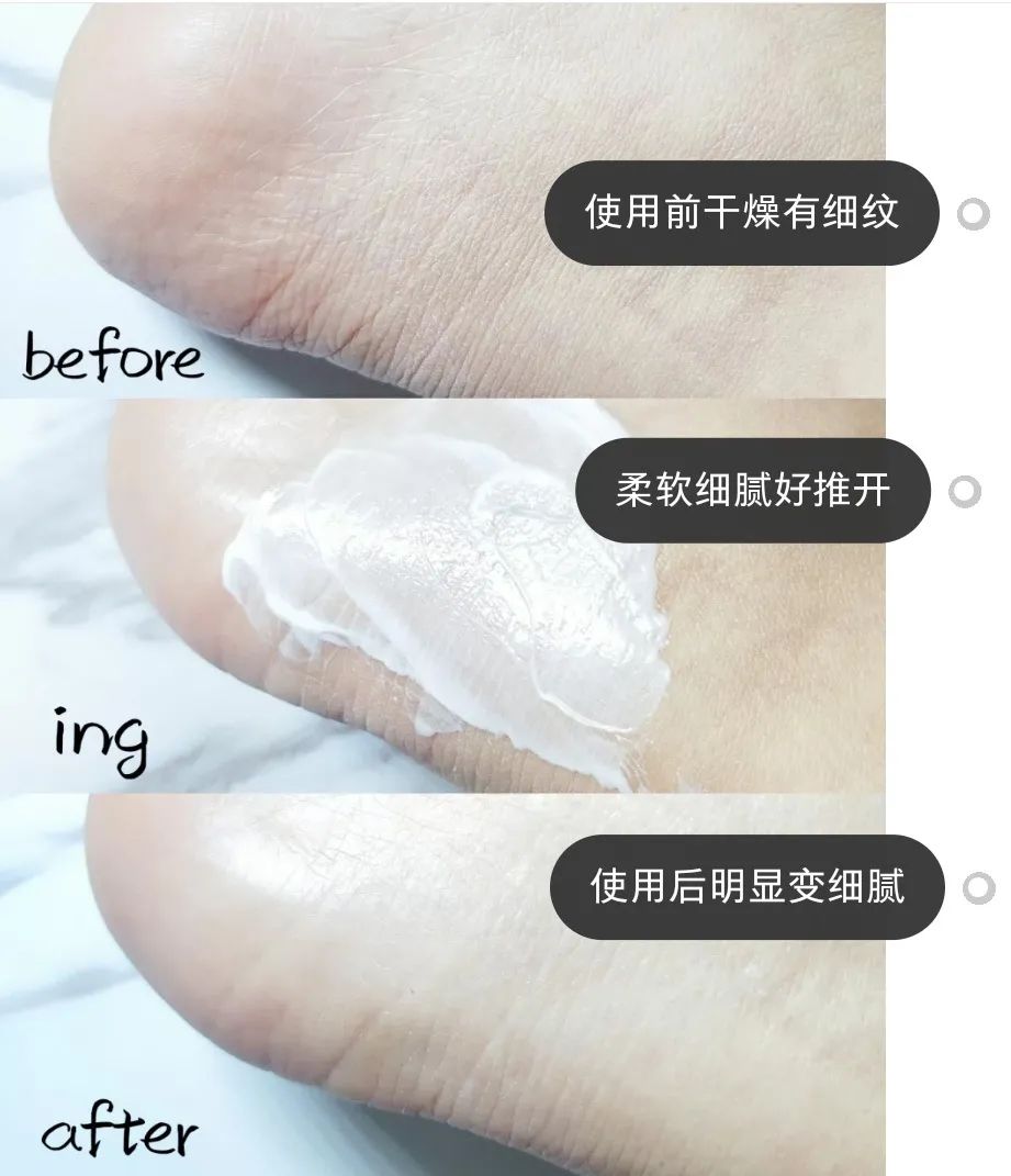 恢复脚部细嫩肌肤(图1) 恢复脚部细嫩肌肤