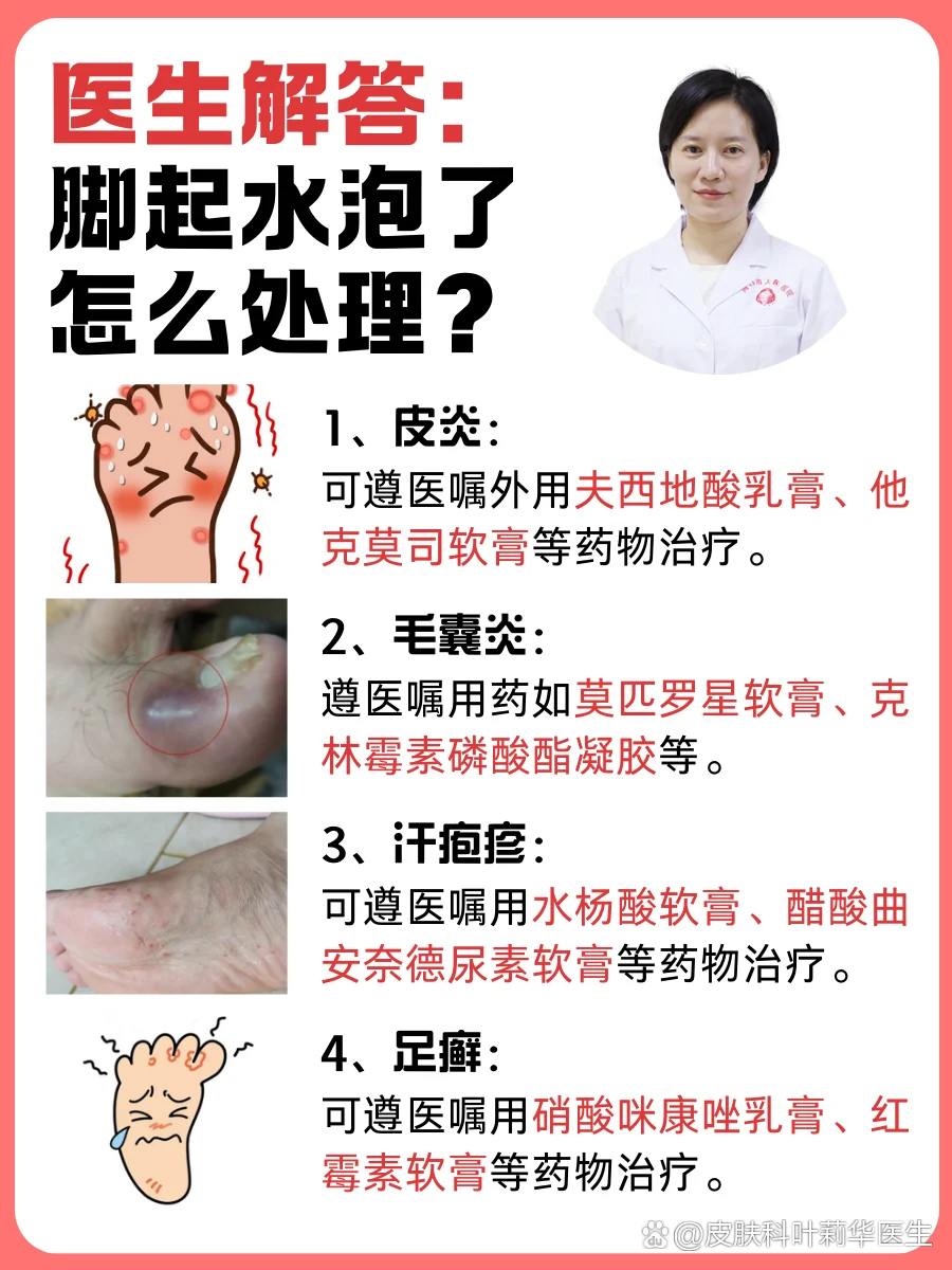 脚部水疱大面积破损处理(图1) 脚部水疱大面积破损处理