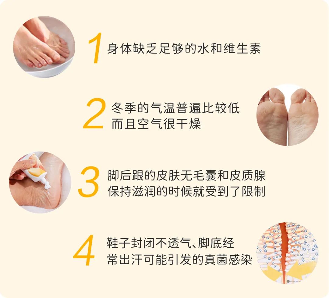 少激素修护脚部脱皮