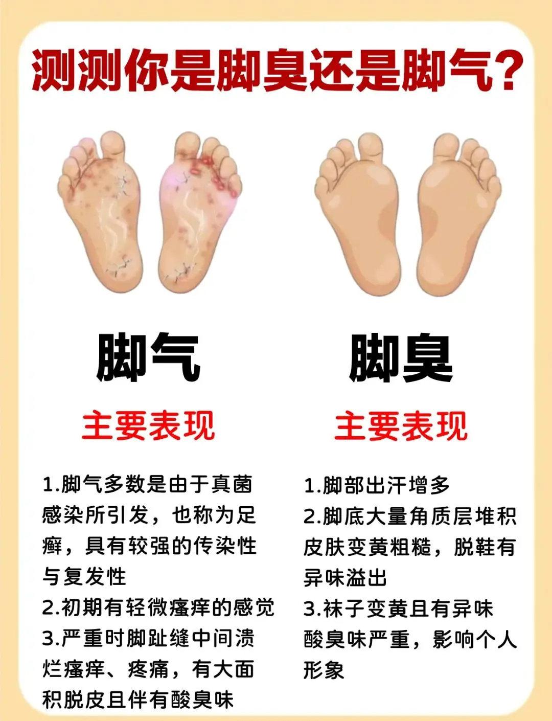 脚部异味四季散发型脚臭成因(图1) 脚部异味四季散发型脚臭成因