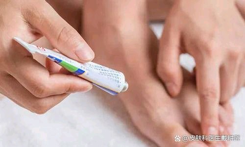 糜烂型脚气运动后紧急护理(图1) 糜烂型脚气运动后紧急护理