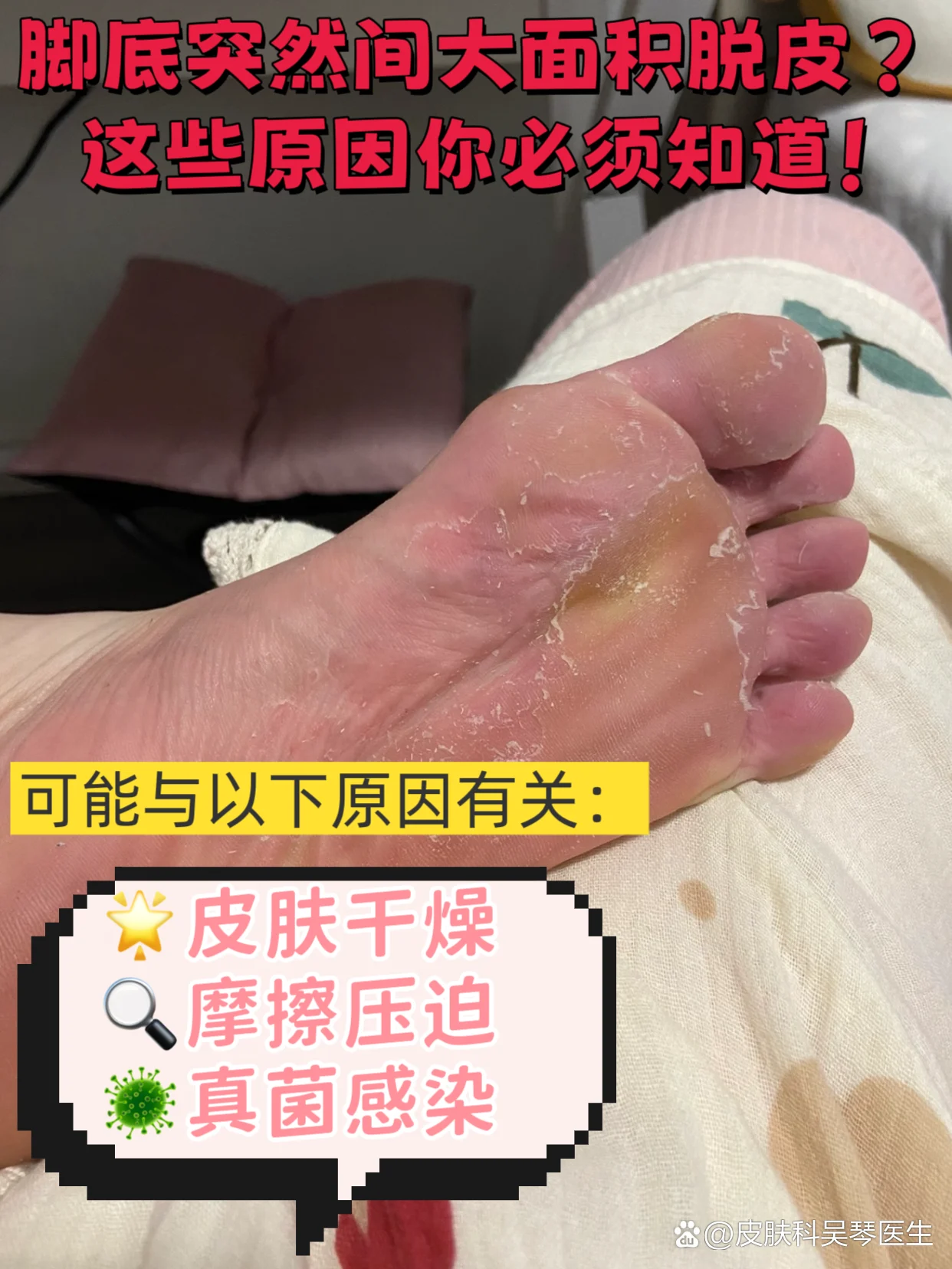 频繁使用洗脚液脱皮