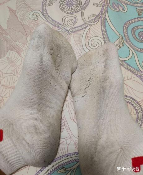 袜子材质粗糙引发脱屑(图1) 袜子材质粗糙引发脱屑