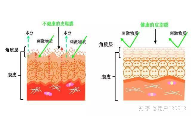 鳞屑脚气皮肤干燥原理