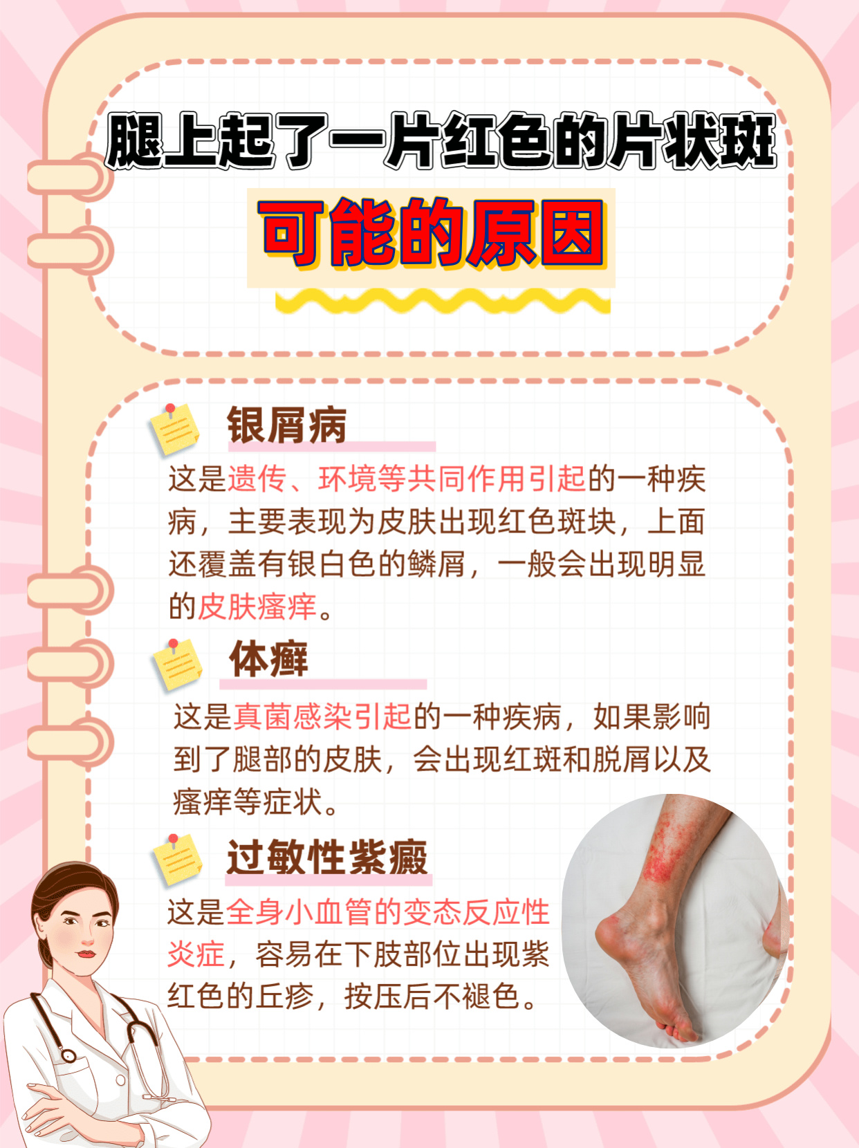 脚部红斑肥胖诱发红斑原因(图1) 脚部红斑肥胖诱发红斑原因