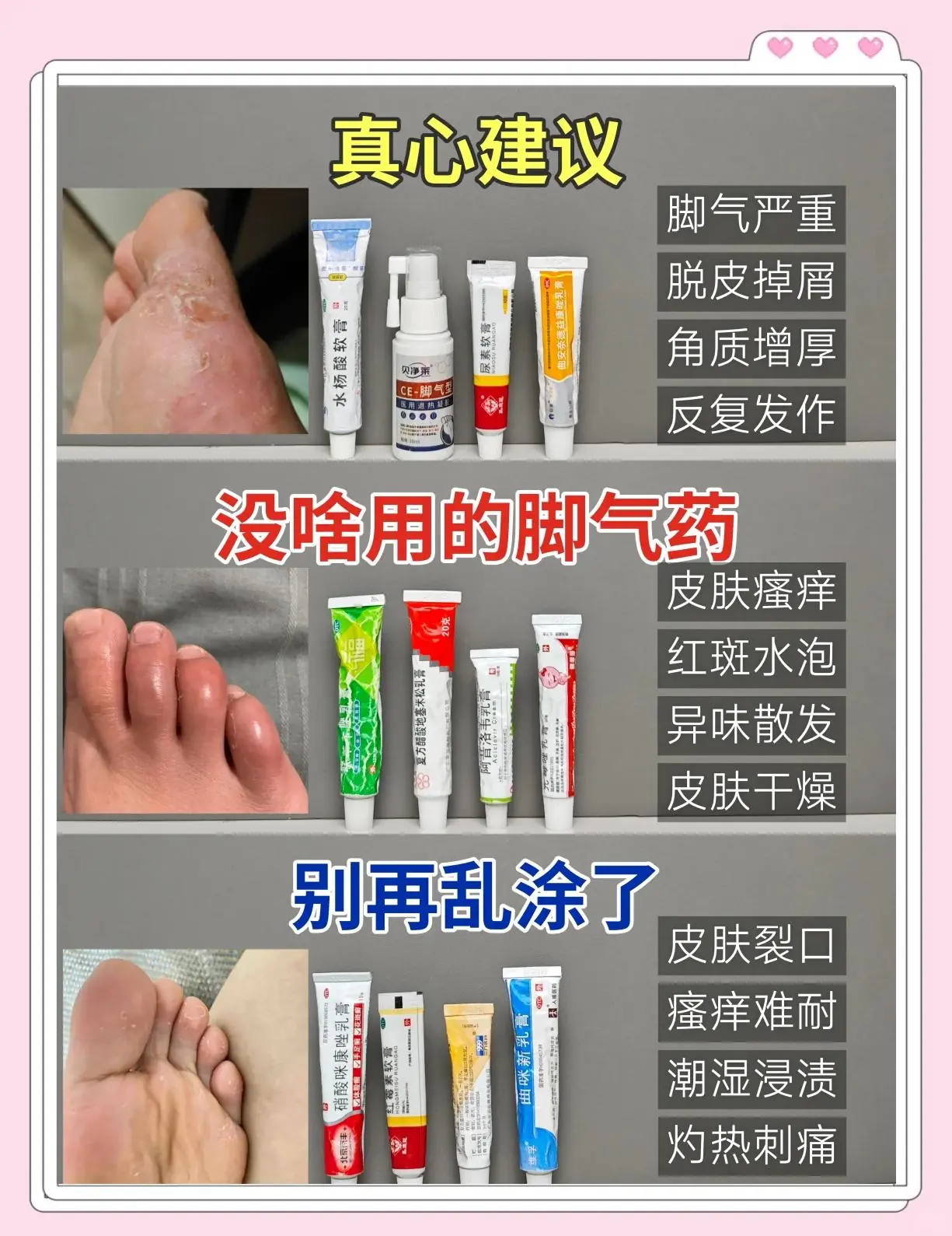 红斑型脚气泡脚药物选择错误(图1) 红斑型脚气泡脚药物选择错误
