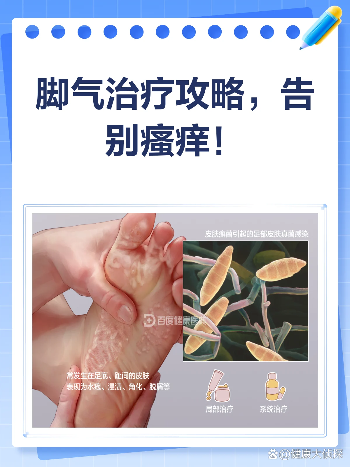 异味型脚气草本温和防治方案(图1) 异味型脚气草本温和防治方案