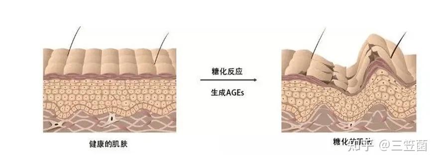 表皮加固减少起皮脱落(图1) 表皮加固减少起皮脱落